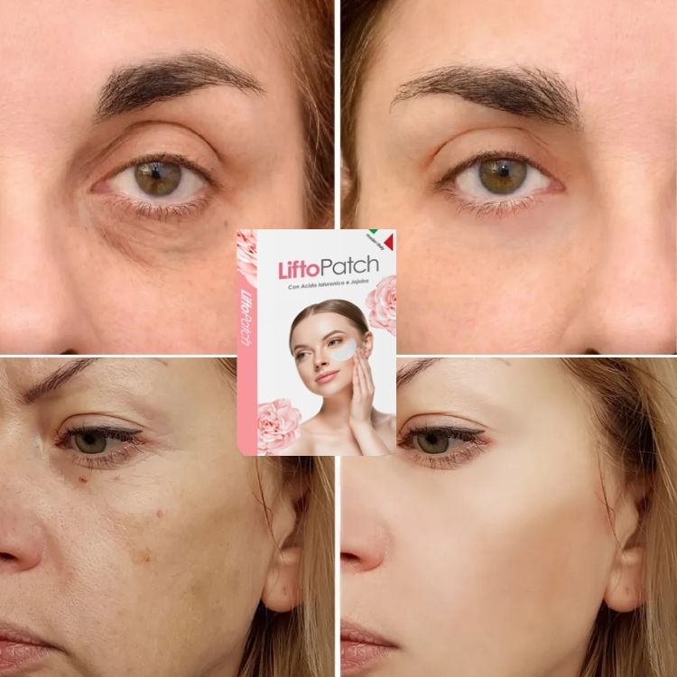 LiftoPatch - 20 Cerotti al Collagene e Acido Ialuronico Idrosolubili